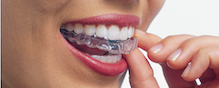 Astoria Dentist Offering Invisalign Invisible Braces in Astoria, NY