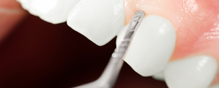gum care and periodontic treatment in Astoria, NY