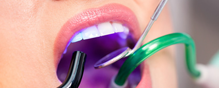 Dr. Spyropoulos and Dr. Abedini are Family Dentists Offering Zoom Tooth Whitening in Astoria, NY
